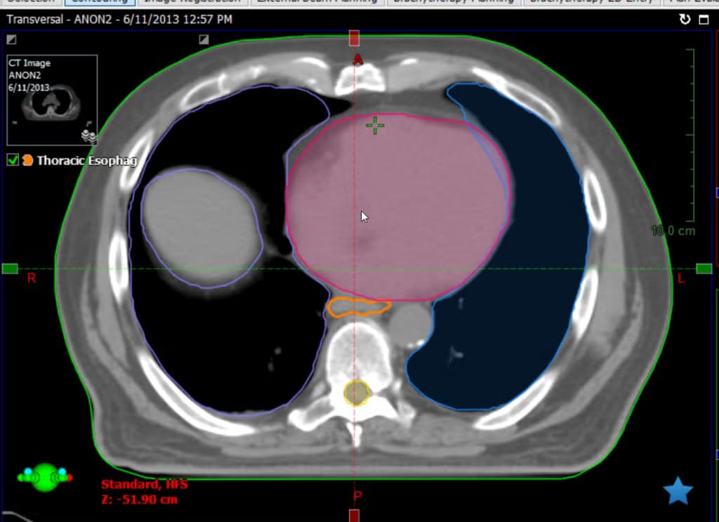 From Prototype to FDA Clearance